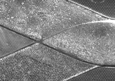 A single channel splits into two micro-channels.